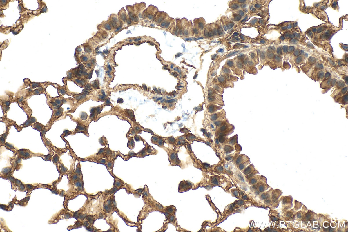 Immunohistochemistry (IHC) staining of mouse lung tissue using GPR4 Polyclonal antibody (28232-1-AP)