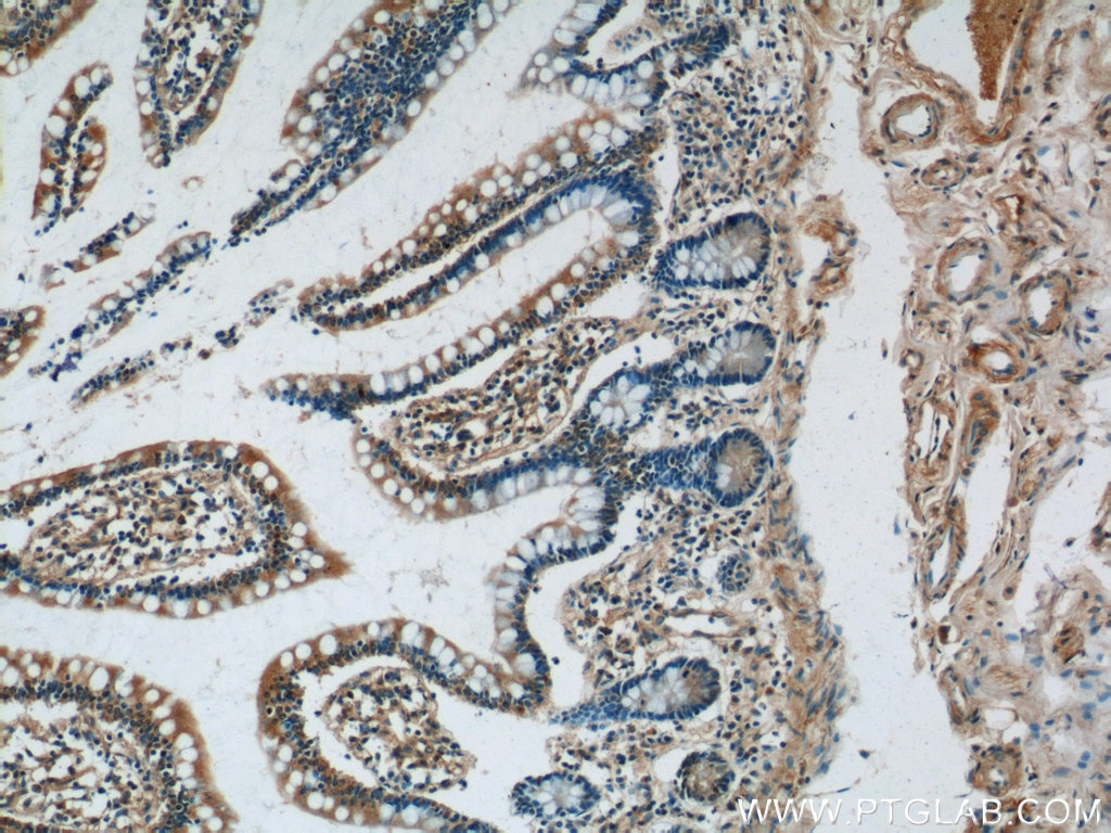 Immunohistochemistry (IHC) staining of human small intestine tissue using GPR44 Polyclonal antibody (25264-1-AP)