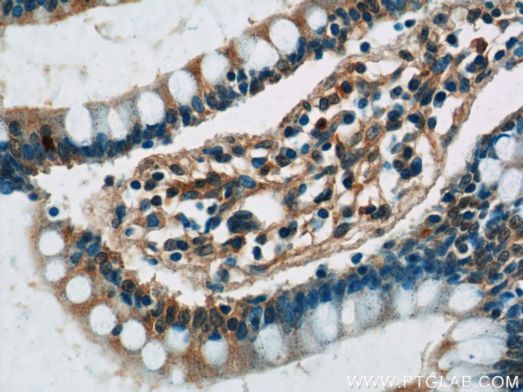 Immunohistochemistry (IHC) staining of human small intestine tissue using GPR44 Polyclonal antibody (25264-1-AP)