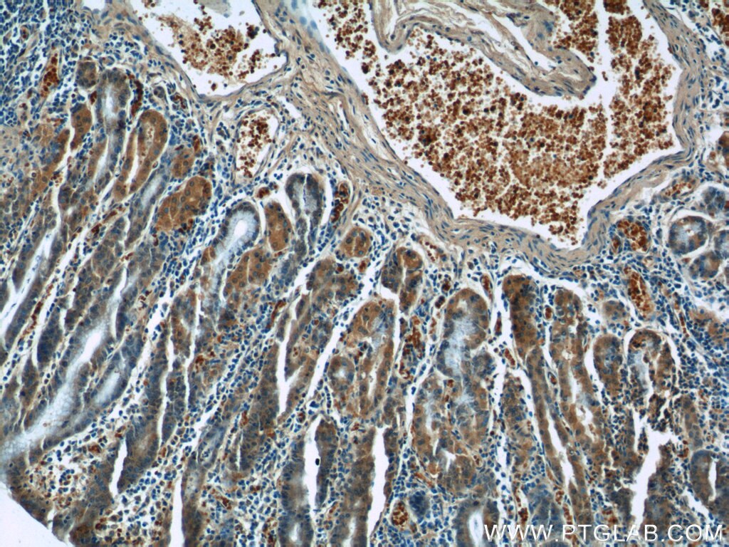 Immunohistochemistry (IHC) staining of human stomach tissue using GPR44 Polyclonal antibody (25264-1-AP)