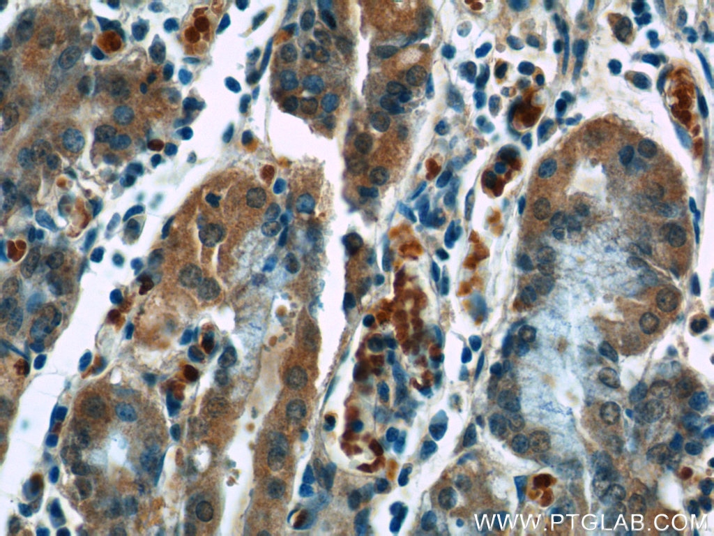 Immunohistochemistry (IHC) staining of human stomach tissue using GPR44 Polyclonal antibody (25264-1-AP)