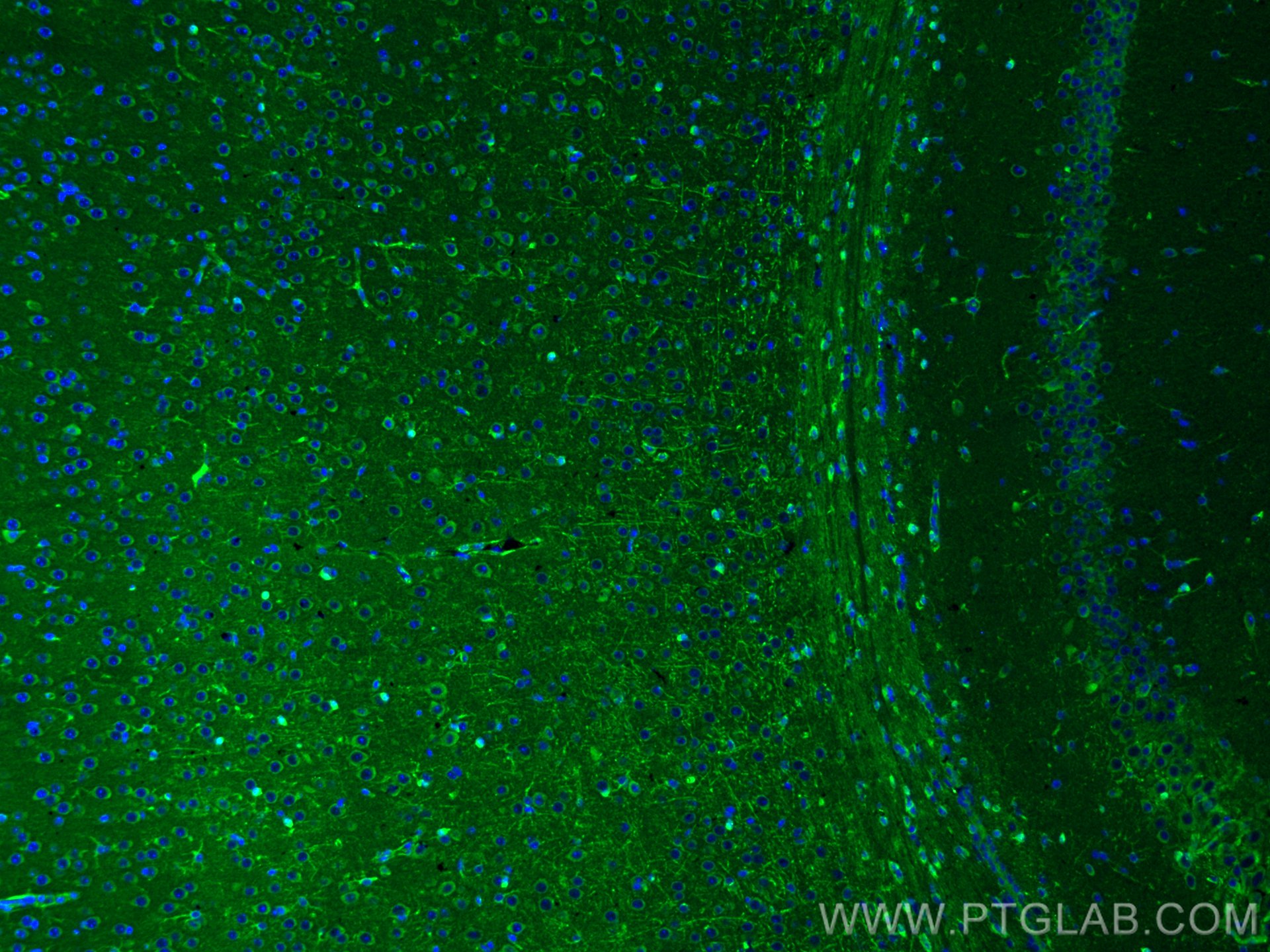 Immunofluorescence (IF) / fluorescent staining of mouse brain tissue using GPR50 Polyclonal antibody (19762-1-AP)