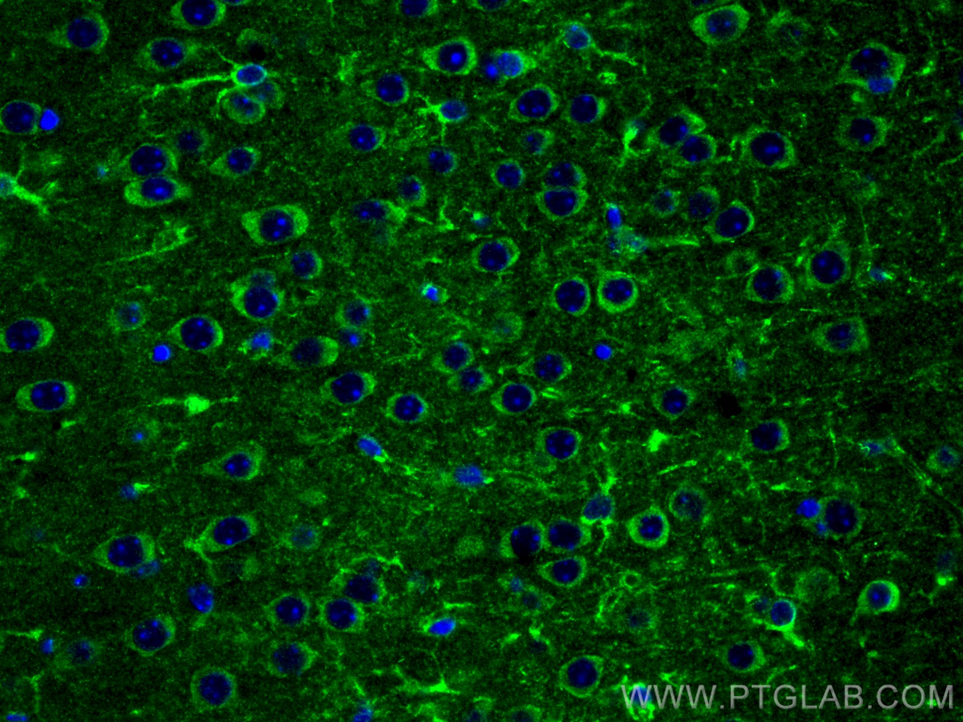 Immunofluorescence (IF) / fluorescent staining of mouse brain tissue using GPR50 Polyclonal antibody (19762-1-AP)