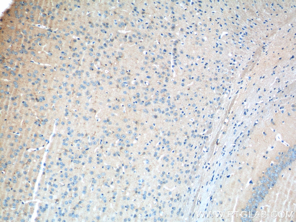 Immunohistochemistry (IHC) staining of mouse brain tissue using GPR50 Polyclonal antibody (19762-1-AP)