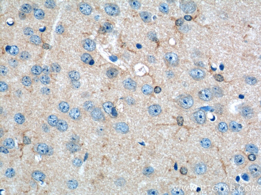 Immunohistochemistry (IHC) staining of mouse brain tissue using GPR50 Polyclonal antibody (19762-1-AP)