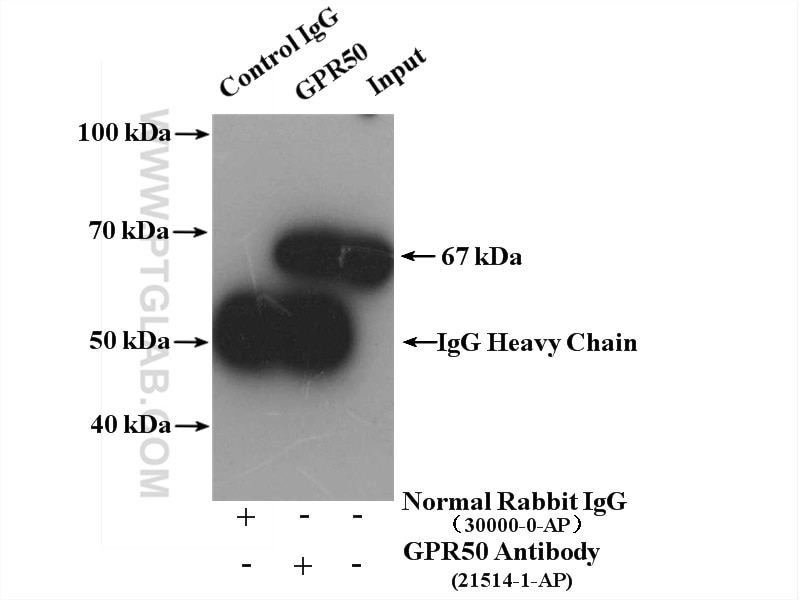 Immunoprecipitation (IP) experiment of HeLa cells using GPR50 Polyclonal antibody (21514-1-AP)