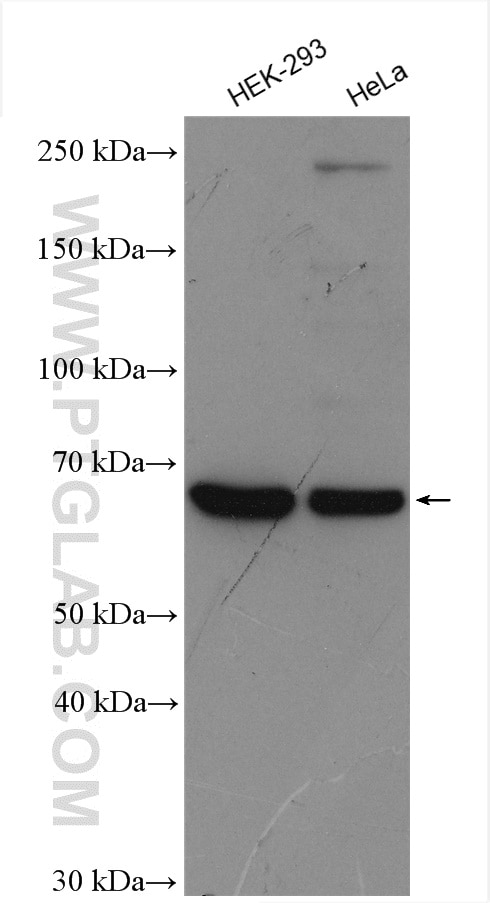 Western Blot (WB) analysis of various lysates using GPR50 Polyclonal antibody (21514-1-AP)