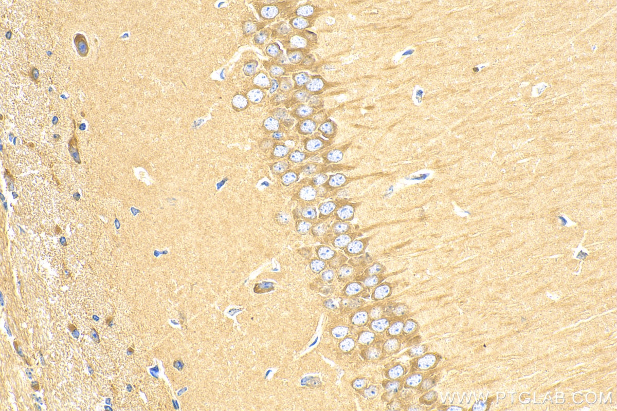 Immunohistochemistry (IHC) staining of mouse brain tissue using GPR52 Polyclonal antibody (30863-1-AP)