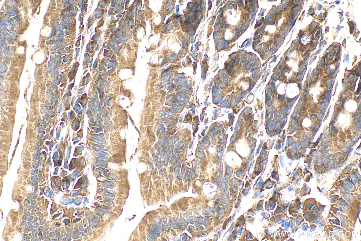 Immunohistochemistry (IHC) staining of mouse small intestine tissue using GPR52 Polyclonal antibody (30863-1-AP)