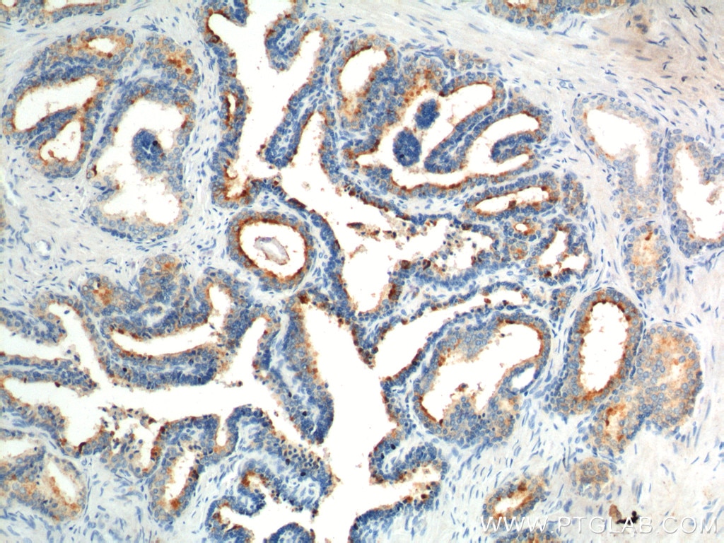 Immunohistochemistry (IHC) staining of human prostate hyperplasia tissue using GPR55 Polyclonal antibody (55249-1-AP)