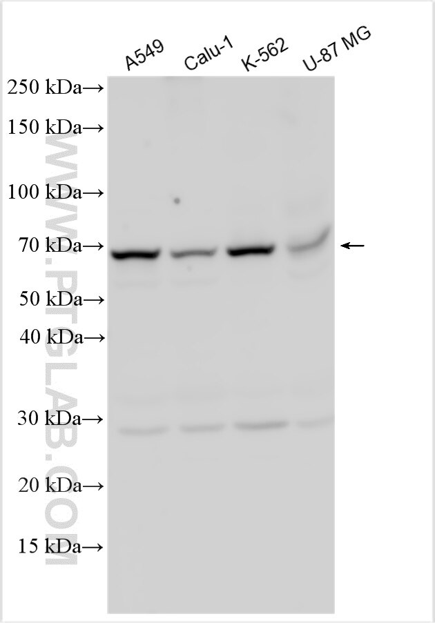 Western Blot (WB) analysis of various lysates using GPR56 Polyclonal antibody (32532-1-AP)
