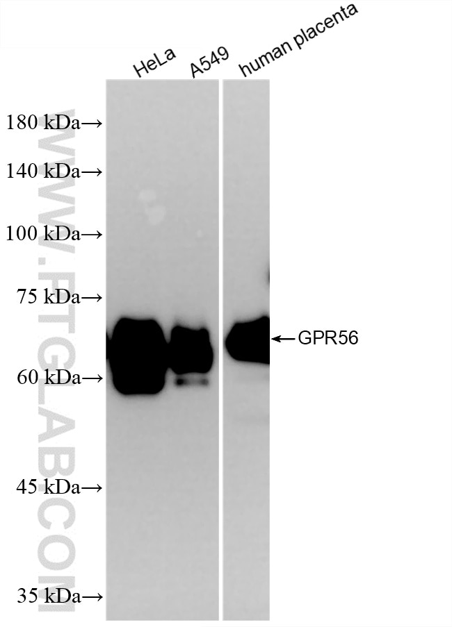 Western Blot (WB) analysis of HeLa cells using GPR56 Recombinant antibody (84915-1-RR)