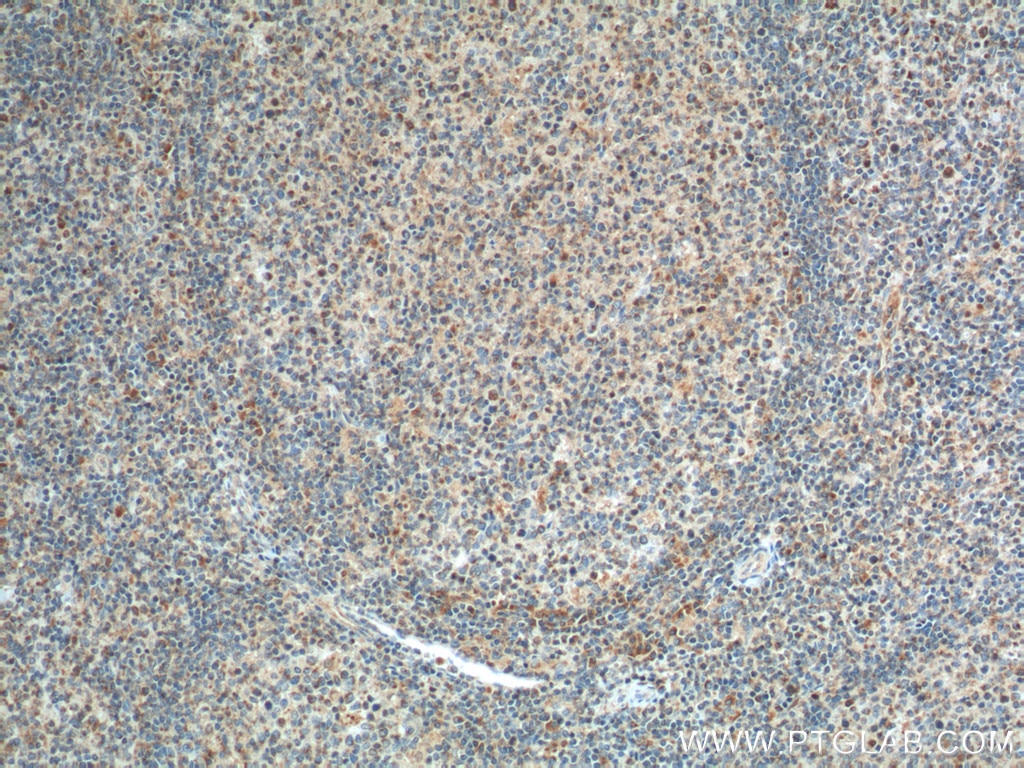 Immunohistochemistry (IHC) staining of human tonsillitis tissue using GPR65 Polyclonal antibody (20306-1-AP)