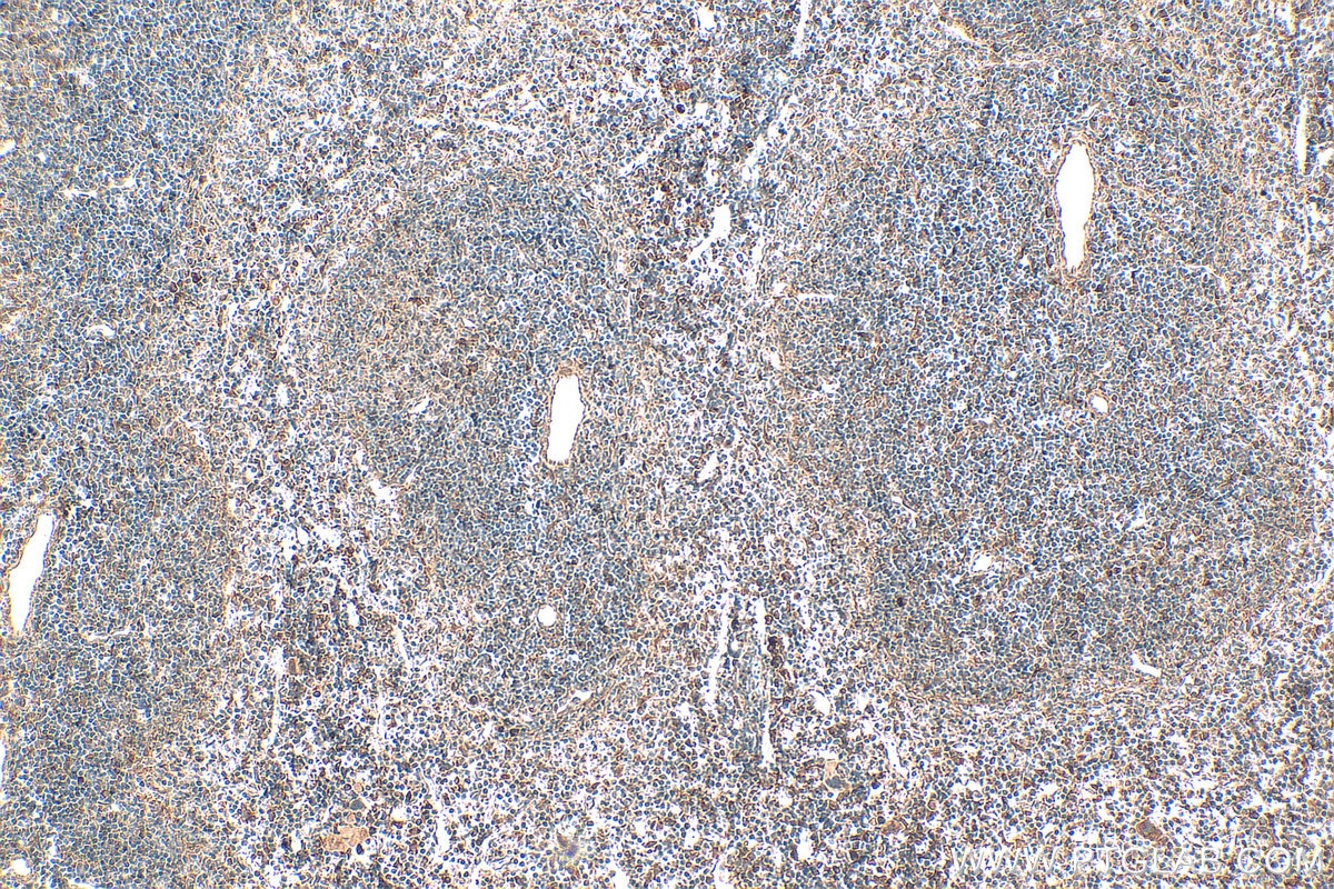 Immunohistochemistry (IHC) staining of mouse spleen tissue using GPR65 Polyclonal antibody (20306-1-AP)