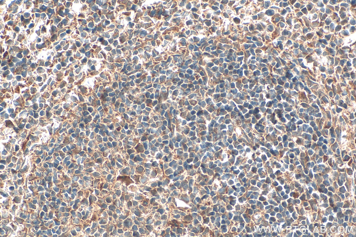 Immunohistochemistry (IHC) staining of mouse spleen tissue using GPR65 Polyclonal antibody (20306-1-AP)