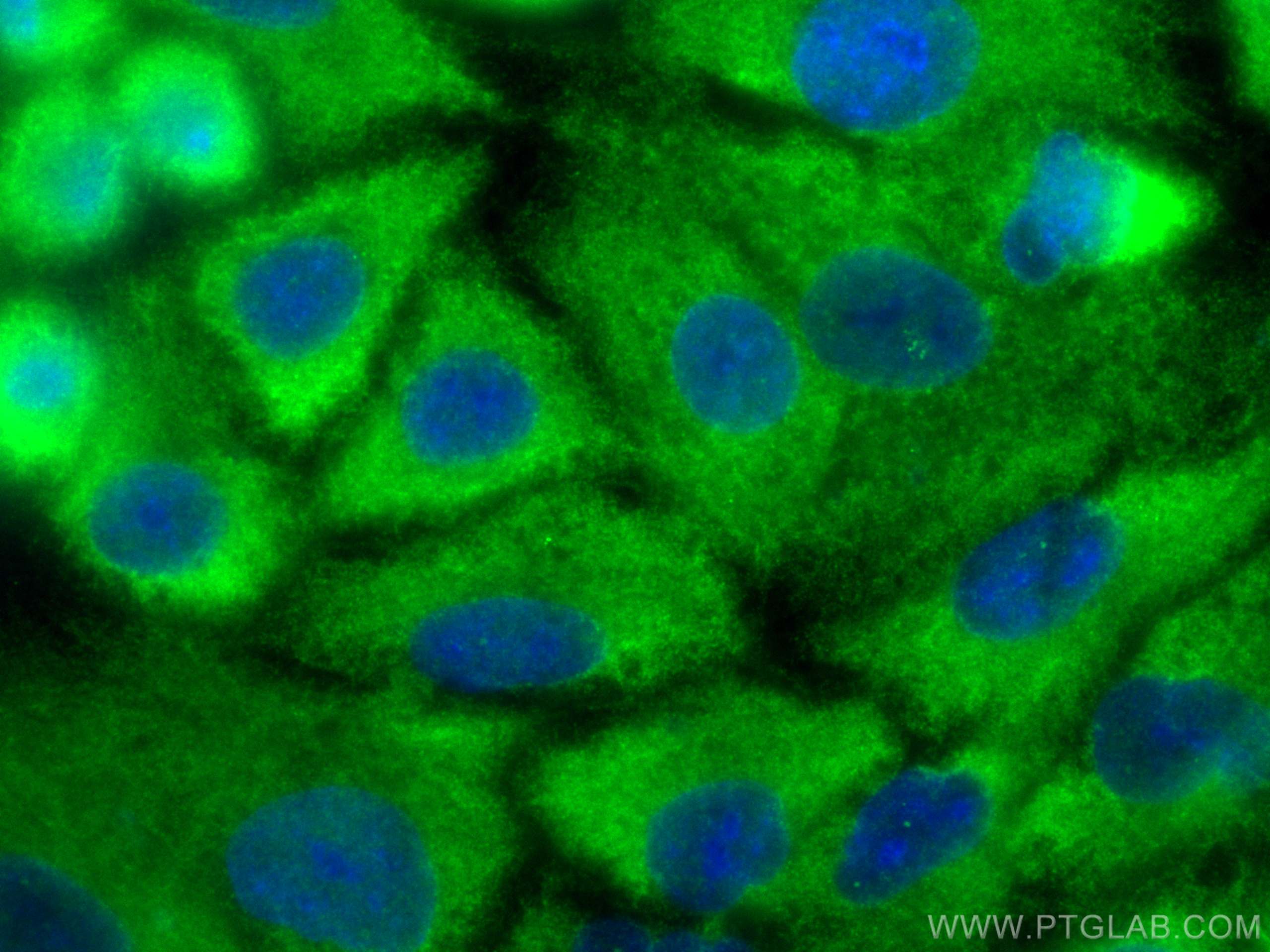 Immunofluorescence (IF) / fluorescent staining of A549 cells using GPR75 Polyclonal antibody (17972-1-AP)