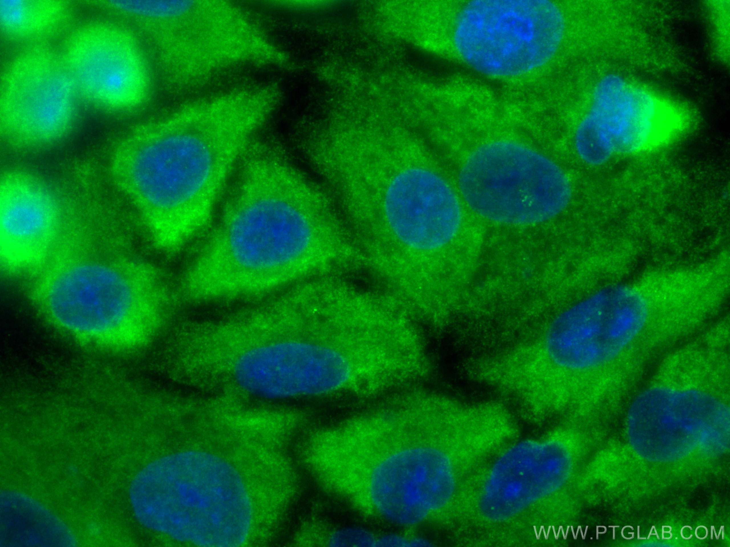 Immunofluorescence (IF) / fluorescent staining of A549 cells using GPR75 Polyclonal antibody (17972-1-AP)