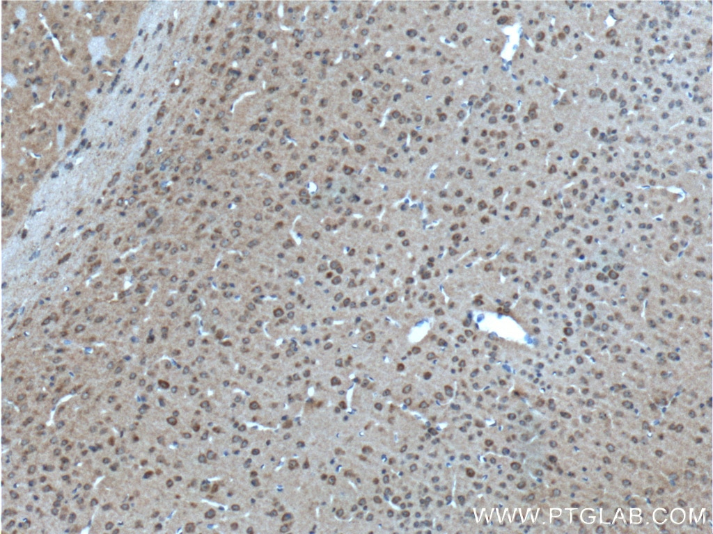 Immunohistochemistry (IHC) staining of mouse brain tissue using GPR75 Polyclonal antibody (17972-1-AP)