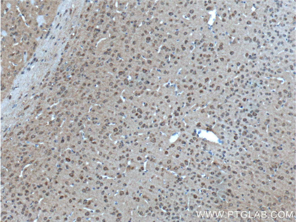 IHC staining of mouse brain using 17972-1-AP