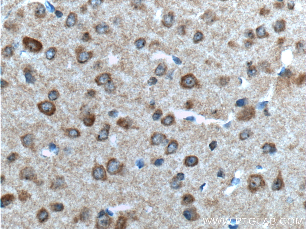 IHC staining of mouse brain using 17972-1-AP