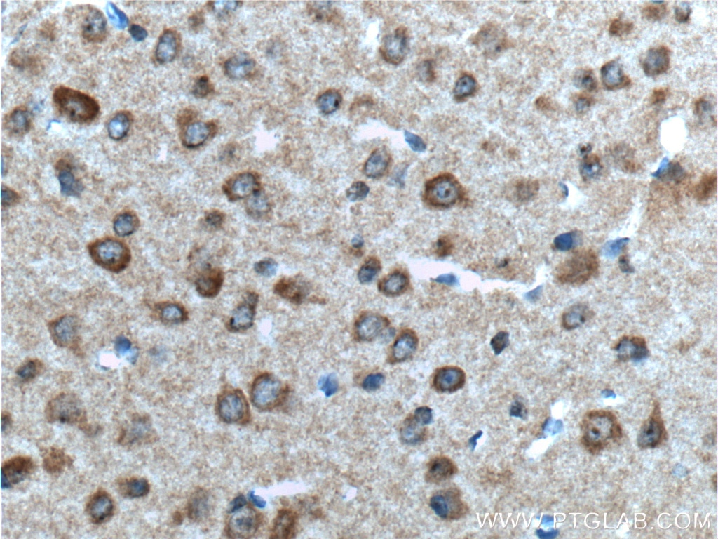 Immunohistochemistry (IHC) staining of mouse brain tissue using GPR75 Polyclonal antibody (17972-1-AP)