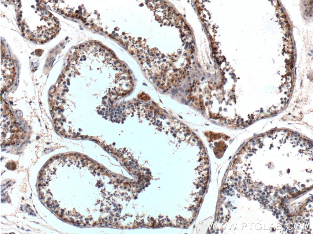 Immunohistochemistry (IHC) staining of human testis tissue using GPR75 Polyclonal antibody (17972-1-AP)