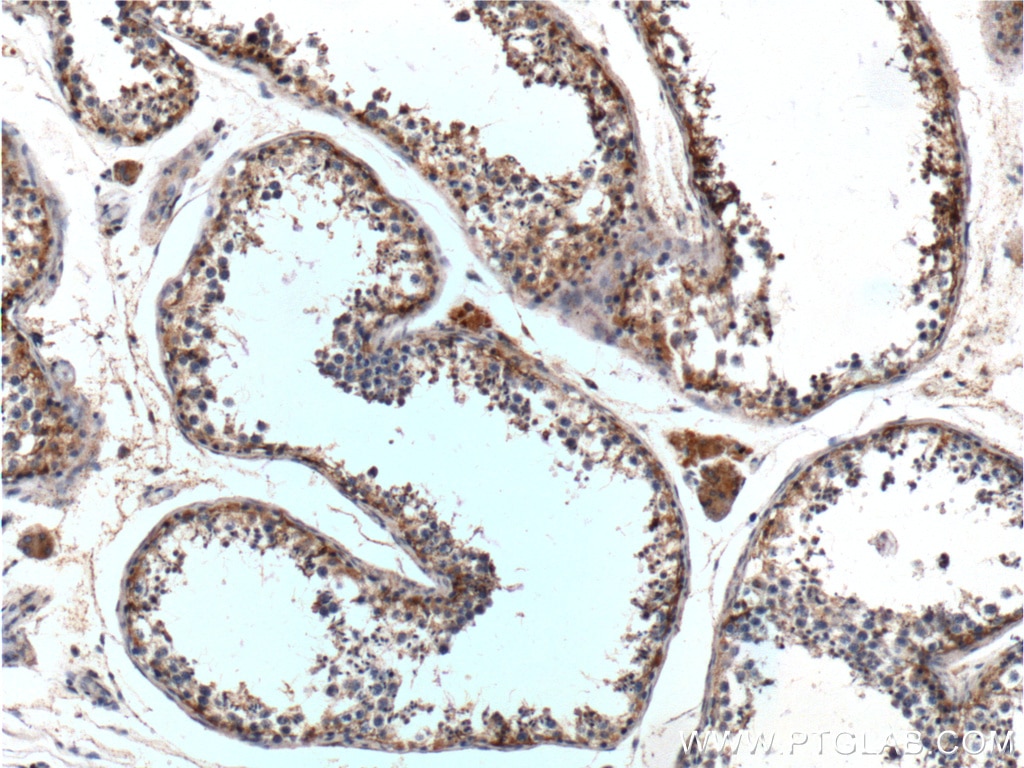 IHC staining of human testis using 17972-1-AP