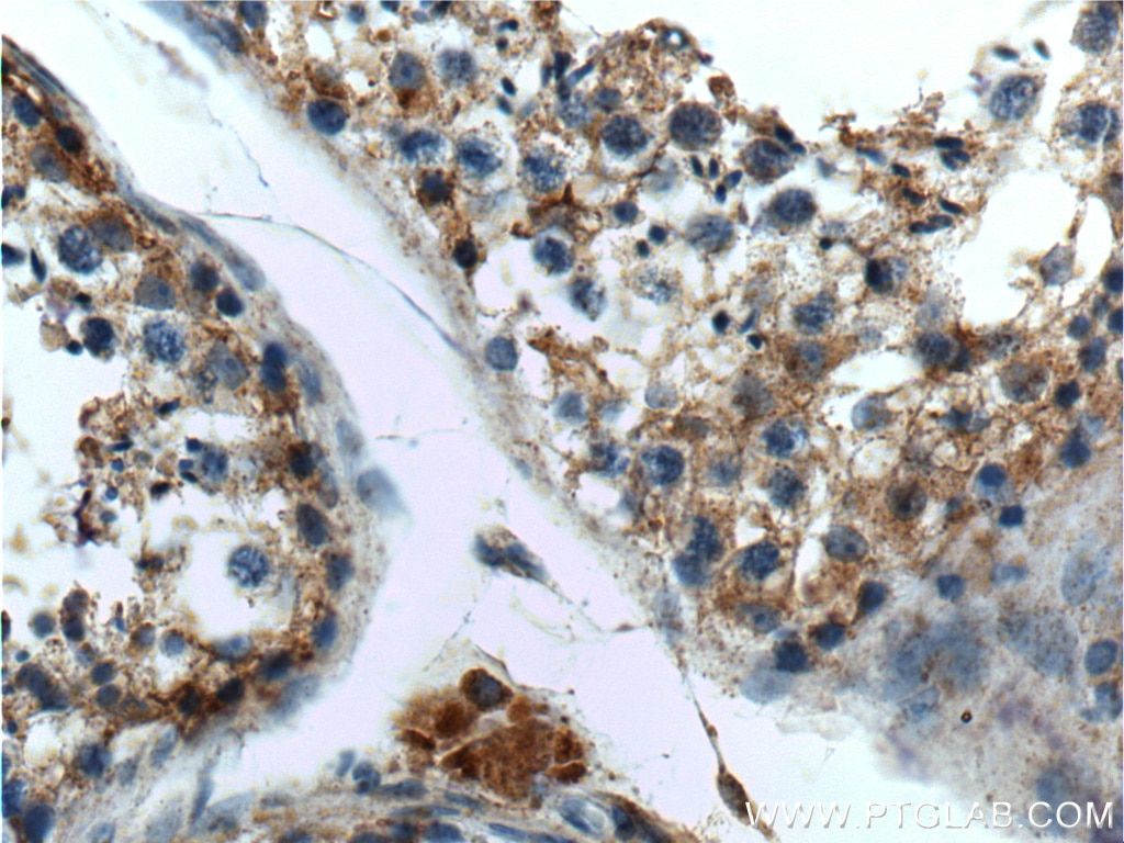 Immunohistochemistry (IHC) staining of human testis tissue using GPR75 Polyclonal antibody (17972-1-AP)