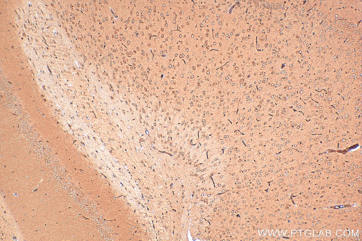 Immunohistochemistry (IHC) staining of mouse brain tissue using GPR75 Polyclonal antibody (17972-1-AP)