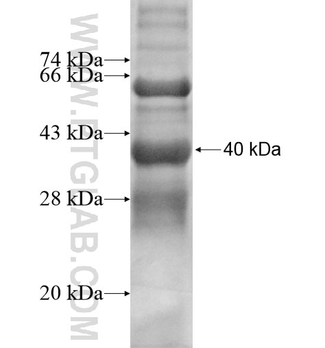 GPR77 fusion protein Ag11836 SDS-PAGE