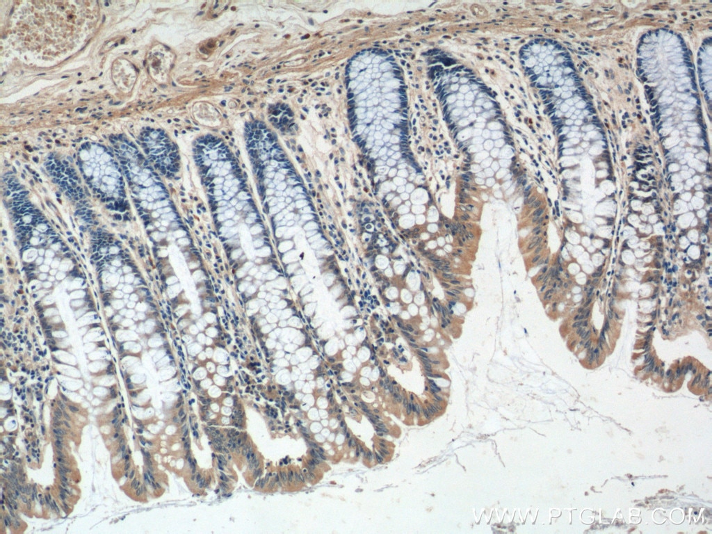 Immunohistochemistry (IHC) staining of human colon tissue using GPR81 Polyclonal antibody (20146-1-AP)