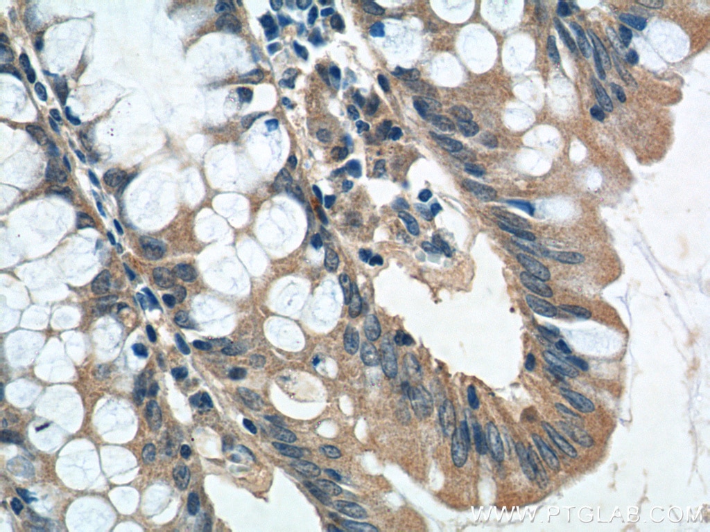 Immunohistochemistry (IHC) staining of human colon tissue using GPR81 Polyclonal antibody (20146-1-AP)