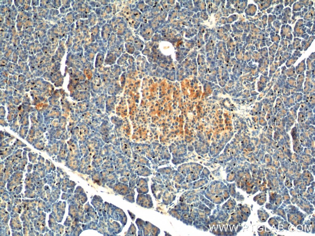 Immunohistochemistry (IHC) staining of human pancreas tissue using GPR81 Polyclonal antibody (20146-1-AP)