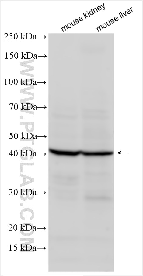 Western Blot (WB) analysis of various lysates using GPR81 Polyclonal antibody (20146-1-AP)