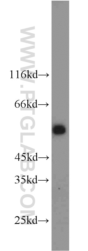 Western Blot (WB) analysis of human brain tissue using GPR83 Polyclonal antibody (23850-1-AP)