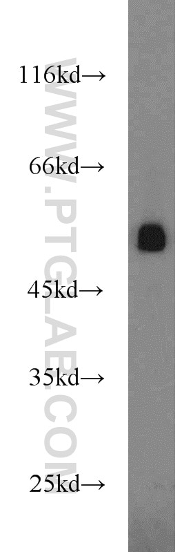 Western Blot (WB) analysis of human brain tissue using GPR83 Polyclonal antibody (23850-1-AP)