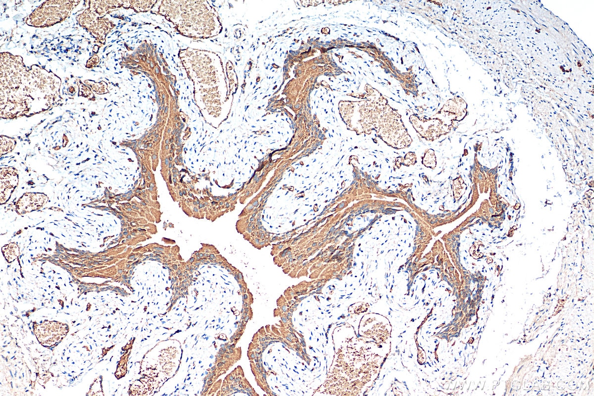 Immunohistochemistry (IHC) staining of mouse bladder tissue using GPR87 Polyclonal antibody (25999-1-AP)