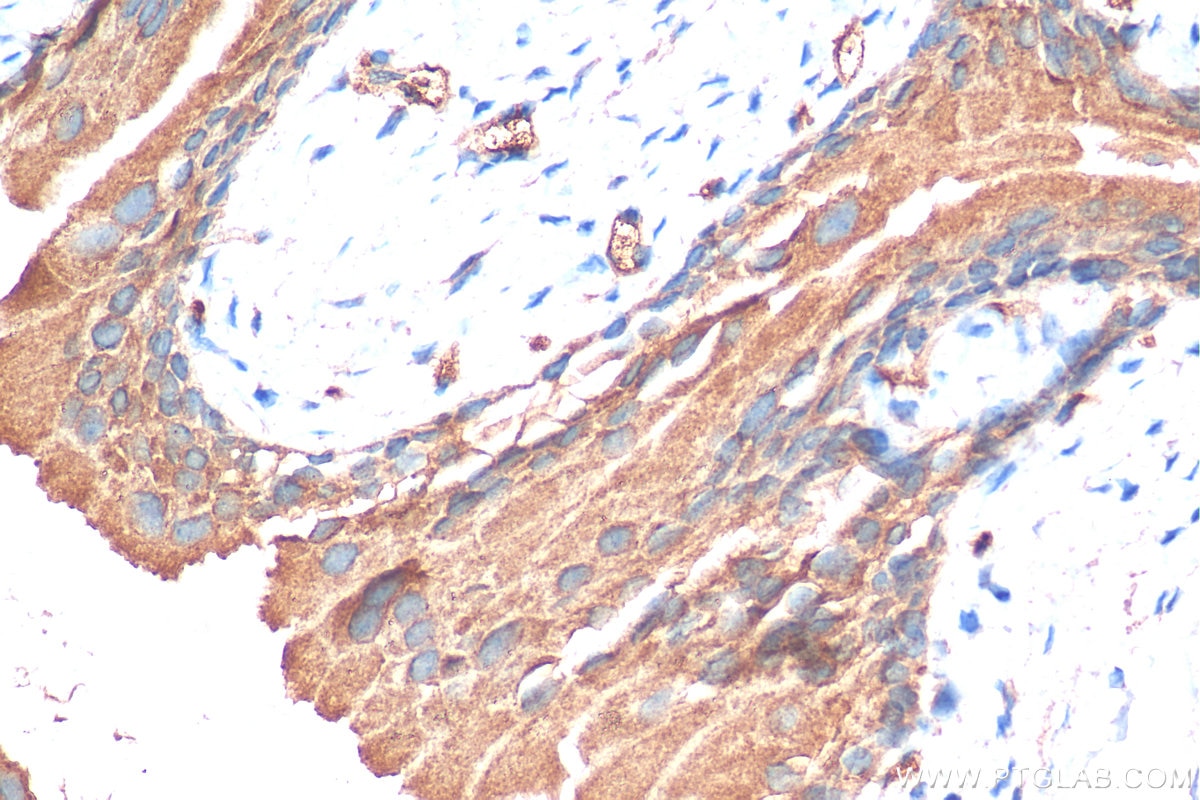 Immunohistochemistry (IHC) staining of mouse bladder tissue using GPR87 Polyclonal antibody (25999-1-AP)