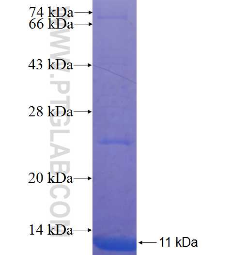 GPR87 fusion protein Ag23277 SDS-PAGE