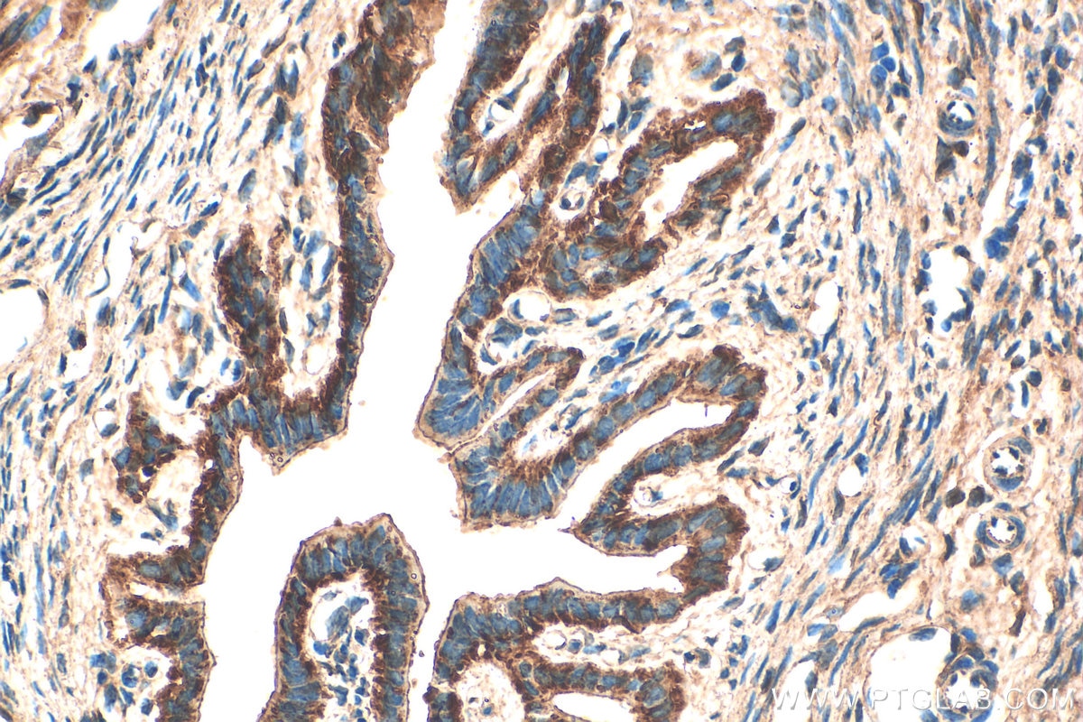 Immunohistochemistry (IHC) staining of mouse ovary tissue using GPR97 Polyclonal antibody (16756-1-AP)