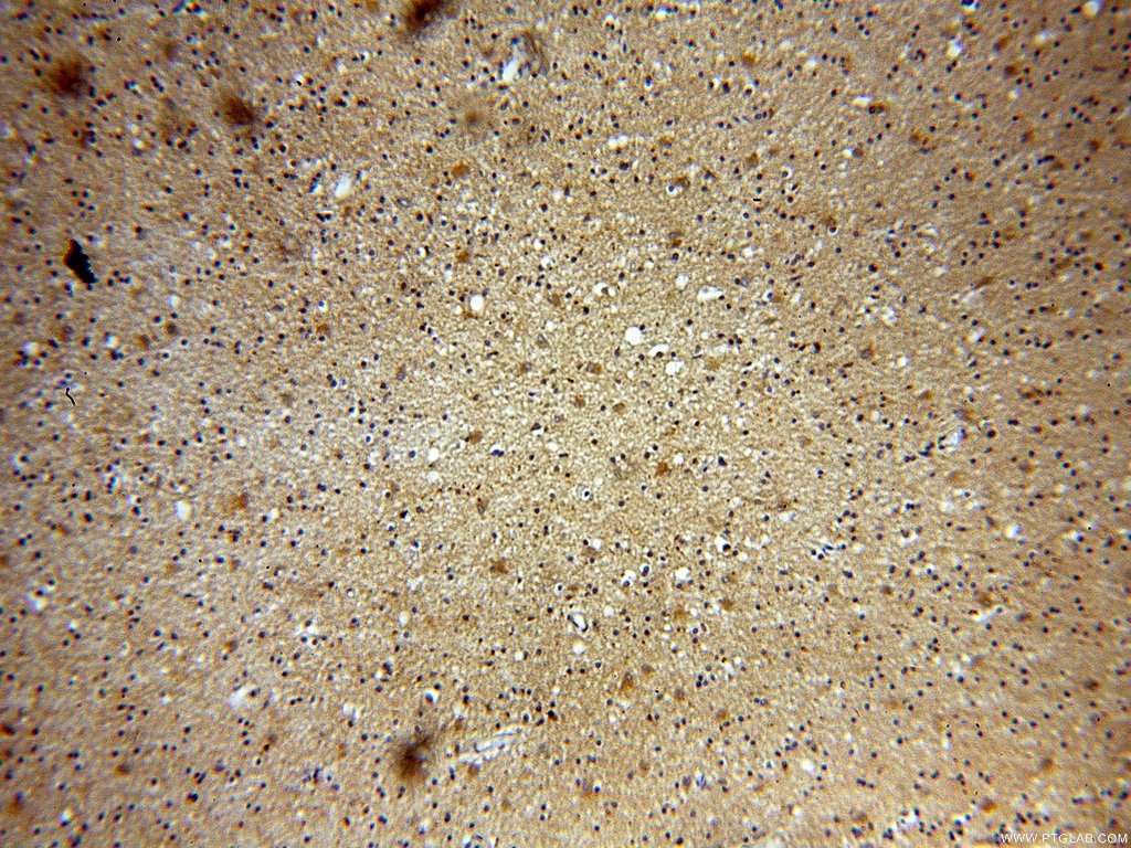 Immunohistochemistry (IHC) staining of human brain tissue using GPRASP1-Specific Polyclonal antibody (20020-1-AP)