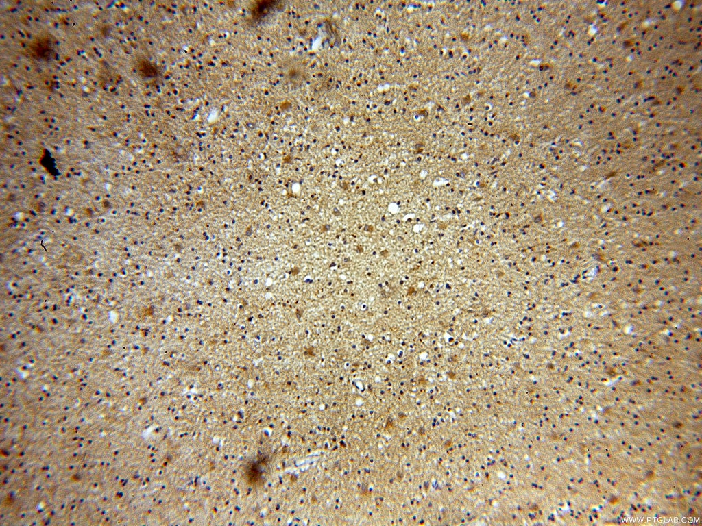 IHC staining of human brain using 20020-1-AP