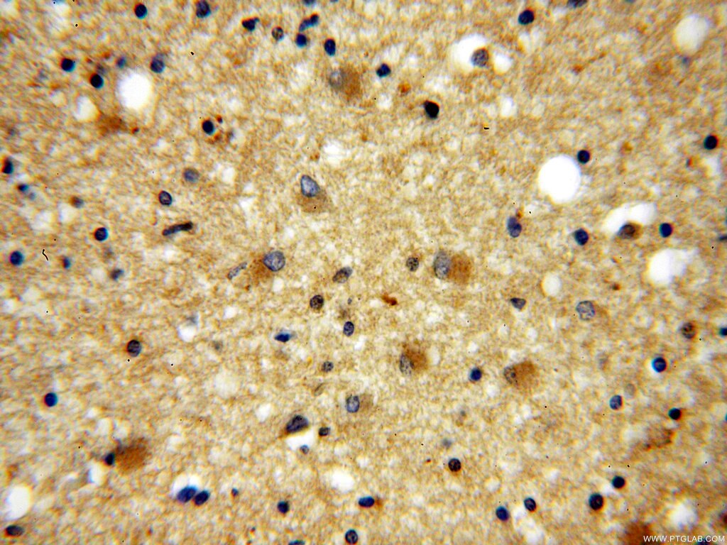 Immunohistochemistry (IHC) staining of human brain tissue using GPRASP1-Specific Polyclonal antibody (20020-1-AP)