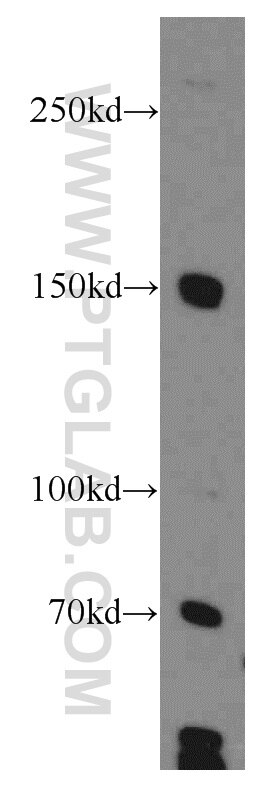 Western Blot (WB) analysis of human brain tissue using GPRASP1-Specific Polyclonal antibody (20020-1-AP)