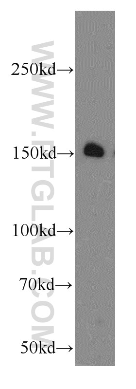 Western Blot (WB) analysis of HepG2 cells using GPRASP1-Specific Polyclonal antibody (20020-1-AP)