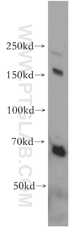Western Blot (WB) analysis of mouse brain tissue using GPRASP1-Specific Polyclonal antibody (20020-1-AP)