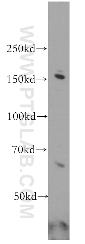 Western Blot (WB) analysis of HeLa cells using GPRASP1-Specific Polyclonal antibody (20020-1-AP)