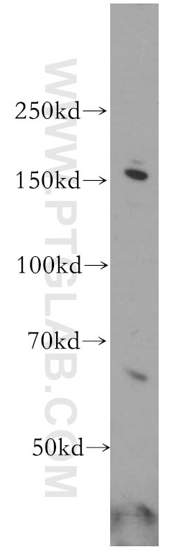 WB analysis of HeLa using 20020-1-AP