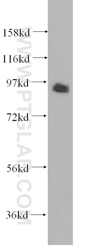 Western Blot (WB) analysis of HEK-293 cells using GPRASP2 Polyclonal antibody (12159-1-AP)