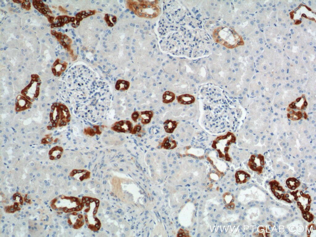 IHC staining of human kidney using 21089-1-AP